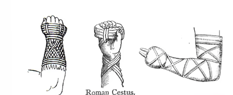 Illustration of ancient Roman cestus gloves, showcasing early boxing protection with straps and metal studs, relevant to the history of boxing gloves.